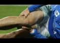 Infortuni Napoli, quattro giocatori verso il rientro! Anguissa &egrave; ancora KO